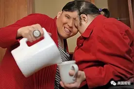 全球最知名连体双胞胎即将62岁，多年姐妹竟变姐弟！图片