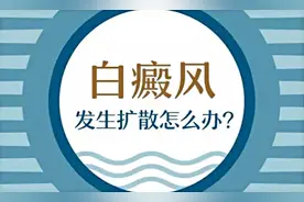 白癜风扩散时会有哪些症状呢?图片