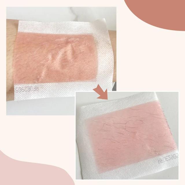 冰点脱毛以后可以擦身体乳吗