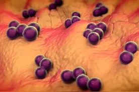 女性“私处”长痘痘，怎么回事？医生：或许5个原因有关，别大意图片