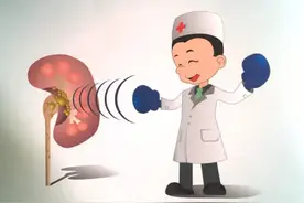 老生常谈：肾结石体外碎石后多久能排出来图片