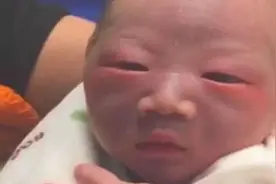 宝宝出生太“丑”全家嫌弃，护士却说很漂亮，一个月后果真逆袭图片