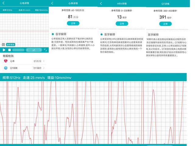 �����˵ĵ�һ����ǻ��ֱ���dido G28S��������