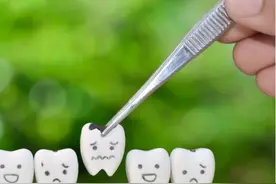 蛀牙了怎么办？深入揭秘蛀牙补牙全过程，爱牙如此重要图片