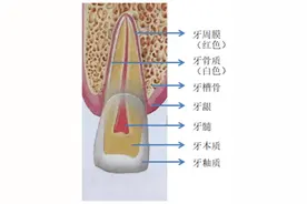 牙齿历险记（第十集）牙源性牙痛图片