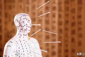 中医起源至今成谜，是史前文明，还是外星人传授？图片