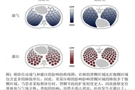 急性低氧性呼吸衰竭和ARDS时的俯卧位图片