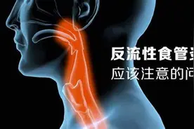 反流性食管炎是什么？如何缓解？图片