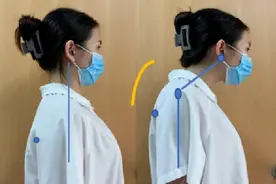 孩子圆肩驼背怎么办？图片