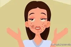 湿疹用什么药好得最快最有效止痒图片