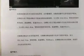 体检发现颈动脉斑块，要不要紧？用不用治疗？图片
