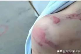 重庆3年级孩子被老师殴打，网友评论一边倒：我们气愤但不上当图片