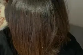 为摆脱头皮屑你做了哪些努力？三款专业去屑洗发水，告别雪花头图片