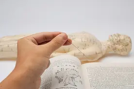 中医针灸师证怎么考？国家承认吗？报考条件和流程？图片