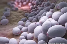 肛门瘙痒怎么办？图片