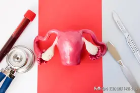 宫颈癌早期症状不典型，若出现3个症状尽早检查，或是宫颈癌信号图片