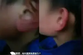 2019年四川一中学生喊校长绰号遭掌掴，六天后学生父亲从病房跳楼图片