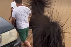 危险！头发突然竖起变“海胆”，小心雷击！专家：千万不要跑图片