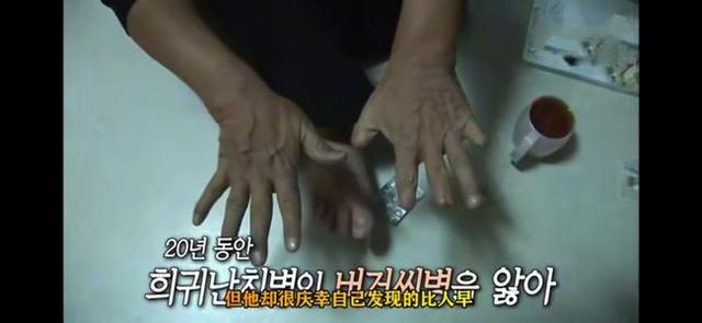 韩国异食癖大叔，一人吃掉了5500多斤味精，身体发生怎样改变？