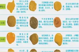 宝宝拉绿便是什么情况？图片