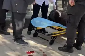 遛狗不拴绳！昆明一女士被狗咬伤，血流了一地！被狗咬伤有多危险图片