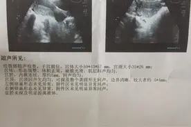 亲身经历药流失败转成功的全过程图片