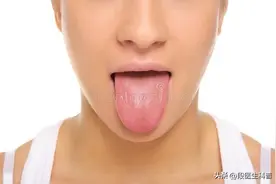 舌苔发白提示什么问题，如何判断严重程度？图片
