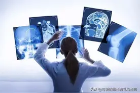 医学影像学专业，会不会接触辐射？本科学习内容有哪些图片