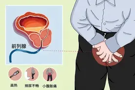 尿频、尿不净？三味药组成的代茶饮，不花一分钱改善前列腺炎图片