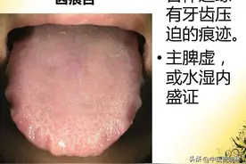 一个方子两味药，用它煮水，帮你从头到脚祛湿，消除齿痕图片