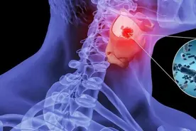 二羊实战总结：新冠退烧后嗓子吞刀片，痰粘难咯，这样破解！图片