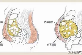 警惕！别看你“长得不显胖”，但内脏脂肪可能已经超标图片