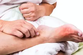 “嘌呤大户”或被揪出，医生直言：不想痛风“缠身”，尽量管住嘴图片