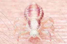 阴虱是什么？为什么现在很多人会得阴虱？真正原因离不开2个途径图片