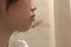 大龄女青年的矫牙路程，舌侧牙套我要贴贴图片