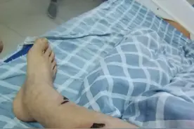 52岁女工车间内被同事开叉车撞伤，怀疑对方故意报复追讨医药费，厂老板称其没伤到筋骨在讹人图片