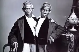 连体人是咋回事？泰国连体兄弟不愿分离，娶姐妹花共同生22个孩子图片