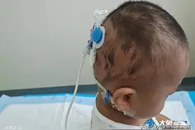 婆媳俩为救1岁重病娃卖掉珍藏首饰嫁妆图片