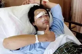 林志颖脸部手术后情况不佳，难恢复到之前容颜，让人想起胡歌车祸图片