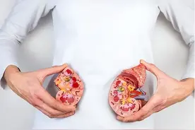 常喝含糖的苏打水会患肾结石？饮食摄入很重要，还有哪些原因？图片