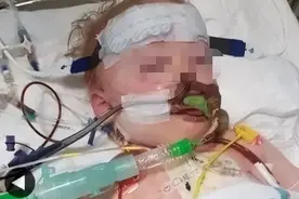 2岁男孩心脏被烧了个洞！误吞纽扣电池的危害，家长绝对想不到图片