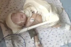 女子发文称分娩中孩子左臂神经被拉断，医院称愿补偿30万元未达成一致，律师：医疗纠纷可多渠道维权图片