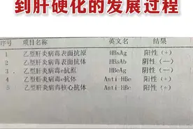 一个乙肝患者到肝硬化的发展过程图片