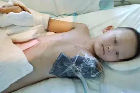 年仅十岁男孩左臂截肢苏醒后 隔屏劝慰妈妈图片