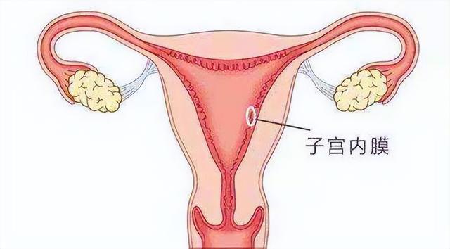 子宫内膜回声不均匀？到底是什么病