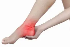 经常腿麻脚麻，要当心这些疾病图片