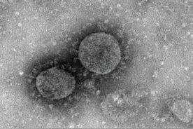 细胞科普｜NK细胞预防和治疗新型冠状病毒感染的可行性分析图片