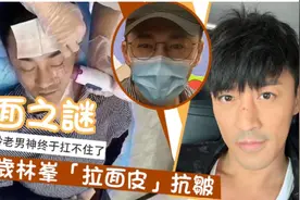 男明星整容后遗症更可怕，有的变成悲伤蛙，有的差点认不出来图片