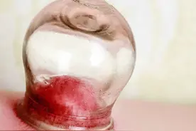 湿气重易生病，推荐这5款祛湿茶，或能有效祛湿排毒，不妨试试图片