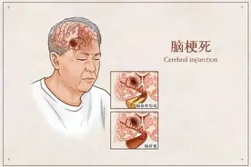 为什么脑梗容易出现在晚上？还呈现年轻化的趋势？医生告诉你答案图片
